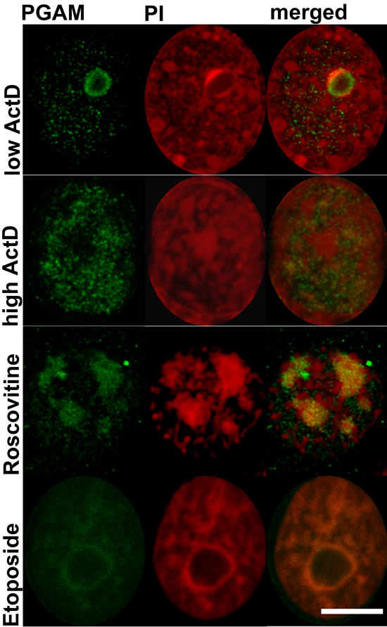 Localization of PGAM with antibody directed to the C-terminal peptide of the protein in nuclei of KLN-205 cells treated with drugs disturbing ribosomal biogenesis.