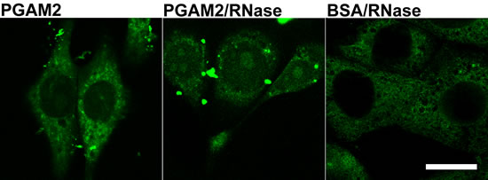 The effects of KLN-205 cells transfection with PGAM2.