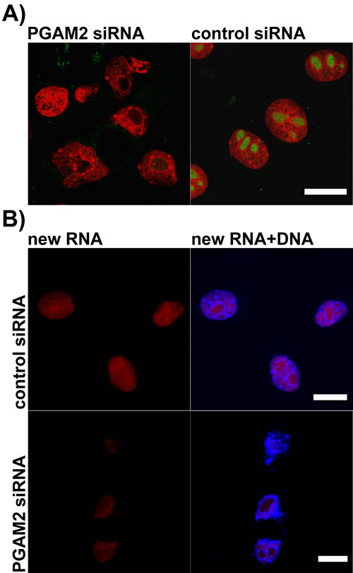 The effects of PGAM2 silencing on nucleolar morphology and new RNA production in KLN-205 cells.
