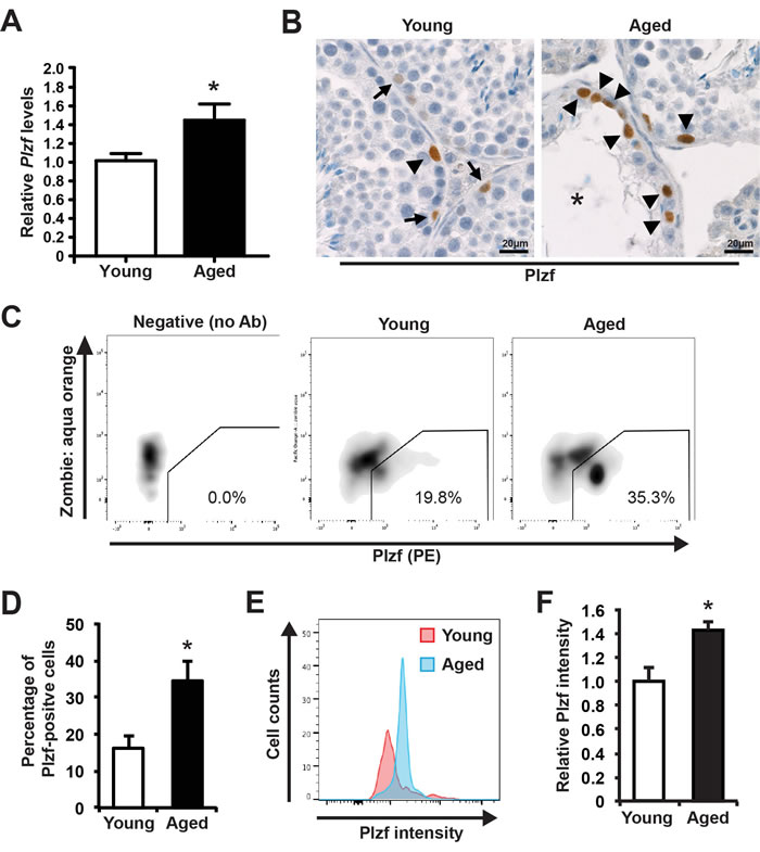 Plzf expression is elevated in aged mouse testes.