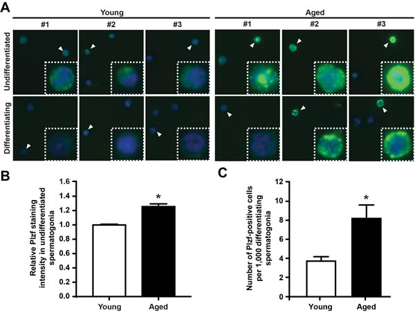 Plzf is expressed in differentiating spermatogonia from aged mouse testes.