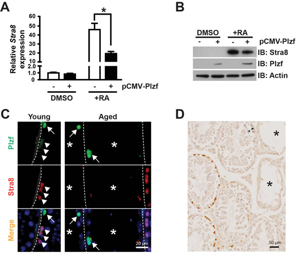Plzf expression inhibits RA-induced Stra8 transcription in F9 cells and correlates with a lack of Stra8-expressing cells in aged testes.