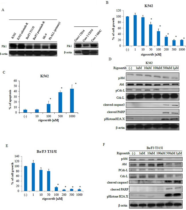 Analysis of polo-like kinase 1 expression and rigosertib activity against Philadelphia (Ph)-positive leukemia cells.