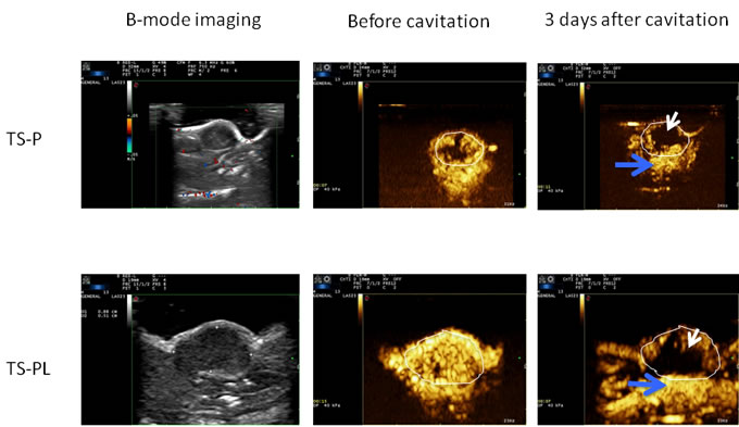 Effect of Up-sized MB on tumor vascular perfusion.