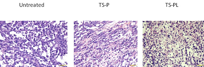 Effect of Up-sized MB on tumor histology