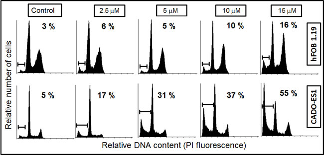 Differential induction of apoptosis in osteoblasts and ES cancer cells by edelfosine.