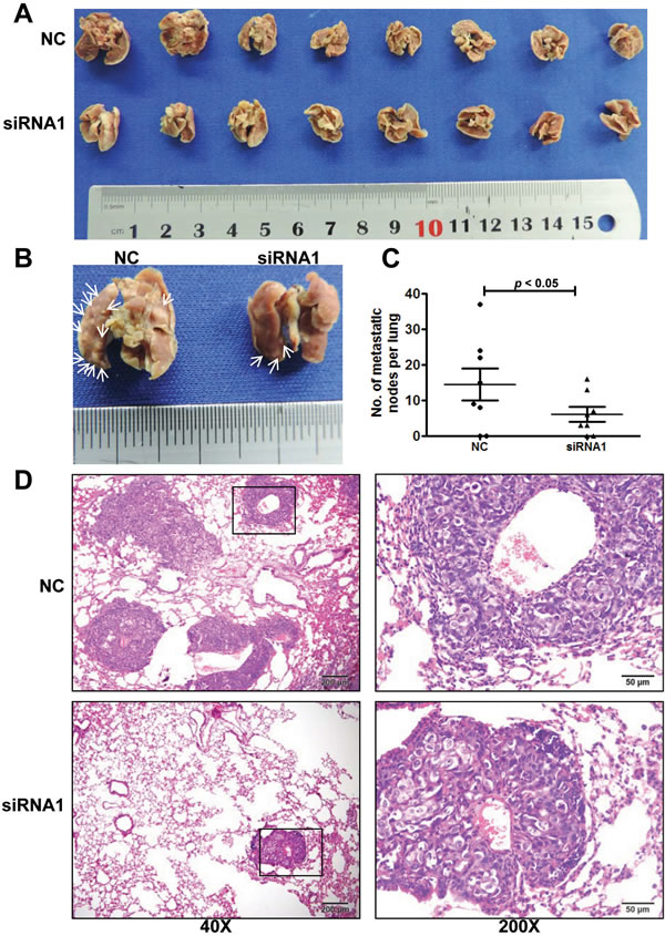AFAP1-AS1 knockdown inhibited NPC 5-8F cell metastasis  in vivo