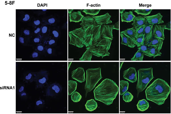AFAP1-AS1 knockdown induced loss of stress filament integrity in cancer cells