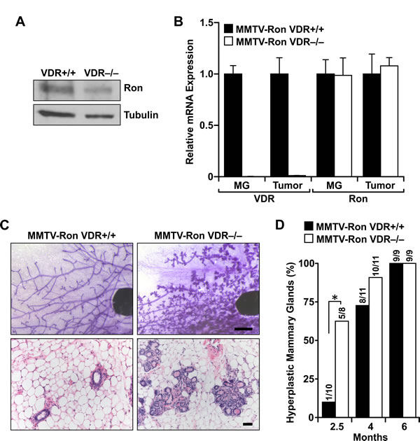 VDR signaling delays Ron-mediated mammary gland hyperplasia.