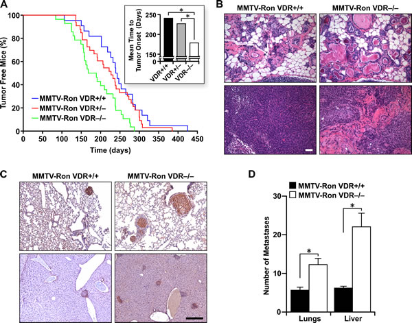 VDR signaling delays mammary tumor formation and alters disease progression in MMTV-Ron mice.