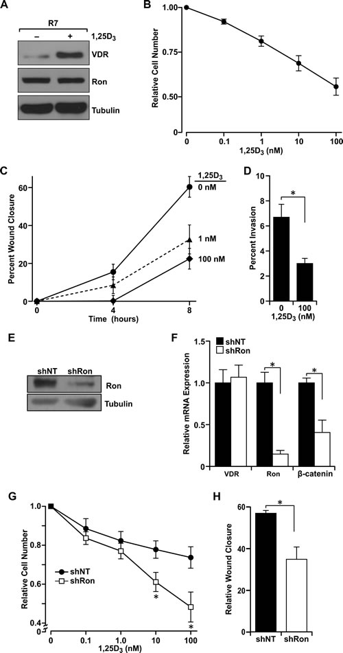 Ron receptor status determines epithelial cell sensitivity to vitamin D