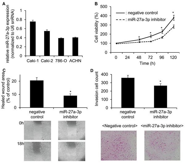 miR-27a-3p inhibitor significantly reduced the cell growth, migration and invasion ability in Caki 1 cells.