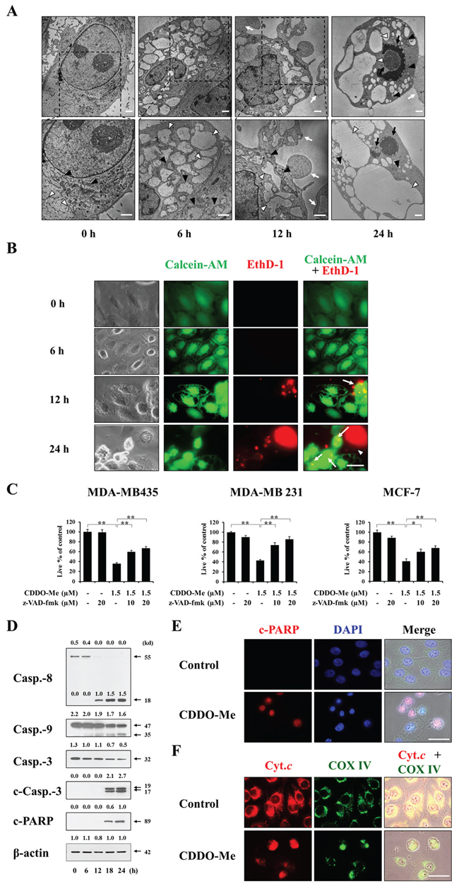 CDDO-Me&#x2013;induced vacuolation is followed by apoptotic cell death in breast cancer cells.