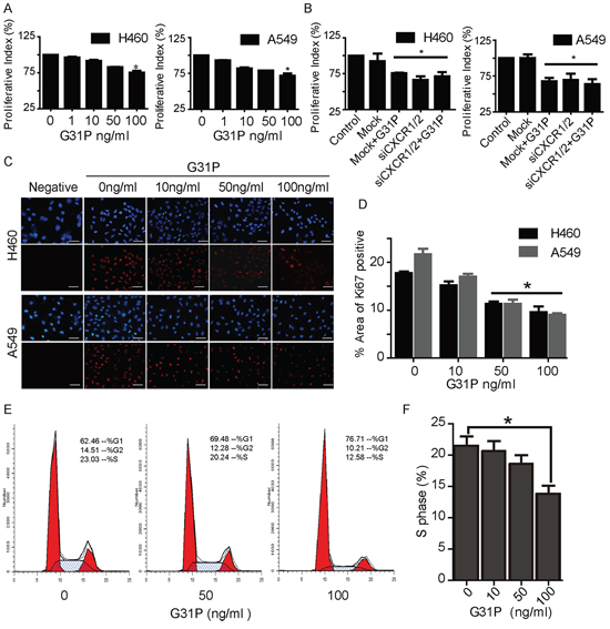 CXCR1/2 antagonism by G31P inhibits NSCLC cell proliferation.