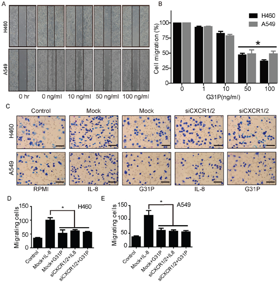 G31P restricts migratory and chemokinetic capacities of H460 and A549 cells.