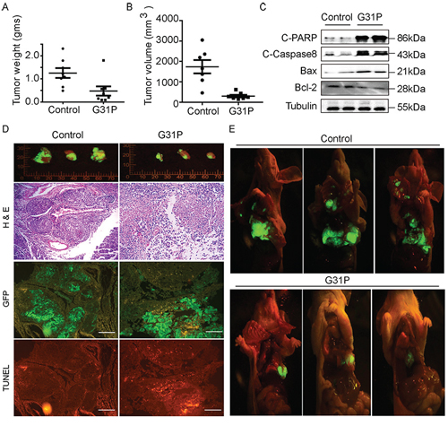 G31P inhibits H460 xenograft growth and metastasis in mouse model.