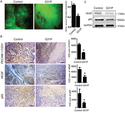 G31P suppresses angiogenesis in xenograft tumor.