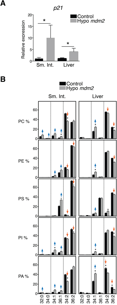 p53 expression causes changes in phospholipid profiles in tissues of Mdm2 mice.