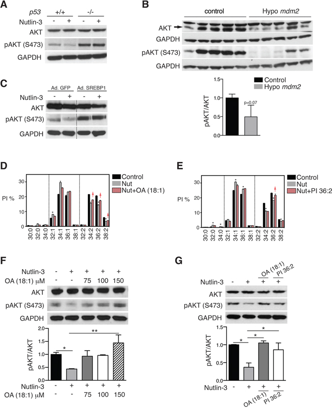 p53-mediated SCD repression attenuates AKT activation.
