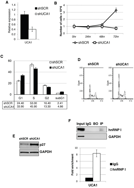 UCA1 sustain AML cell proliferation and regulated p27kip1 expression.