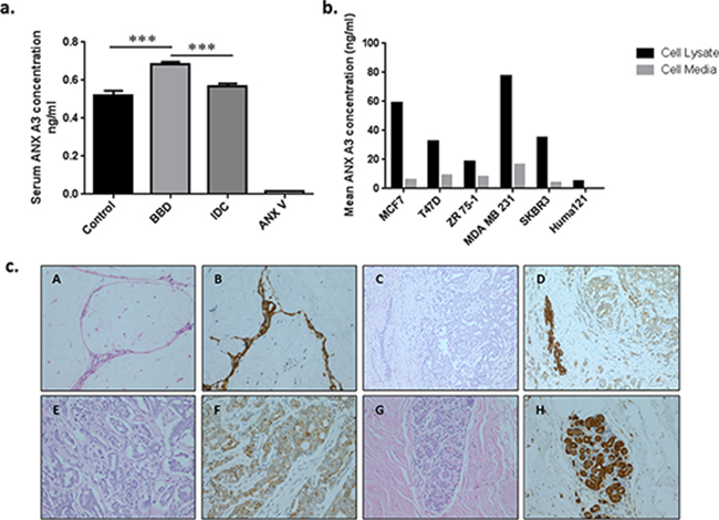 Immuno-validation and tissue correlation of ANX A3.