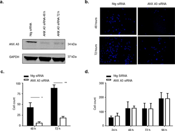 ANX A3 silencing inhibits migration of MCF7 cells.