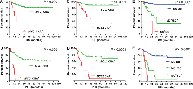 Overall survival and progression-free survival of cases grouped according to MYC CNA 2A&#x2013;2B, BCL2 CNA 2C&#x2013;2D and double CNA 2E&#x2013;2F.