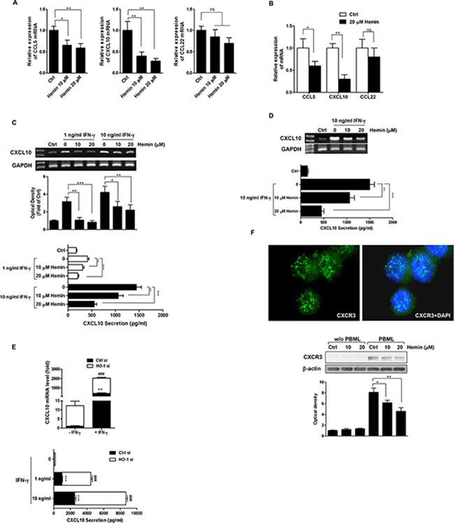 Effects of HO-1 on CXCL10 expression and secretion in CRC cells.