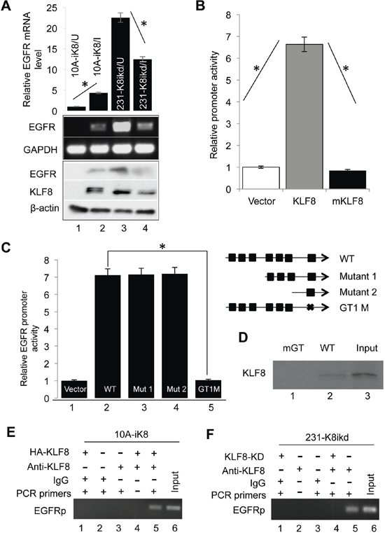 KLF8 upregulates EGFR expression at the transcriptional level.