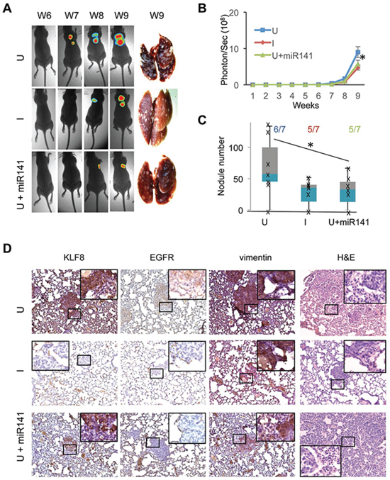 Overexpression of miR141 recapitulates the inhibitory effect of KLF8 knockdown on the tumor metastasis to the lungs.