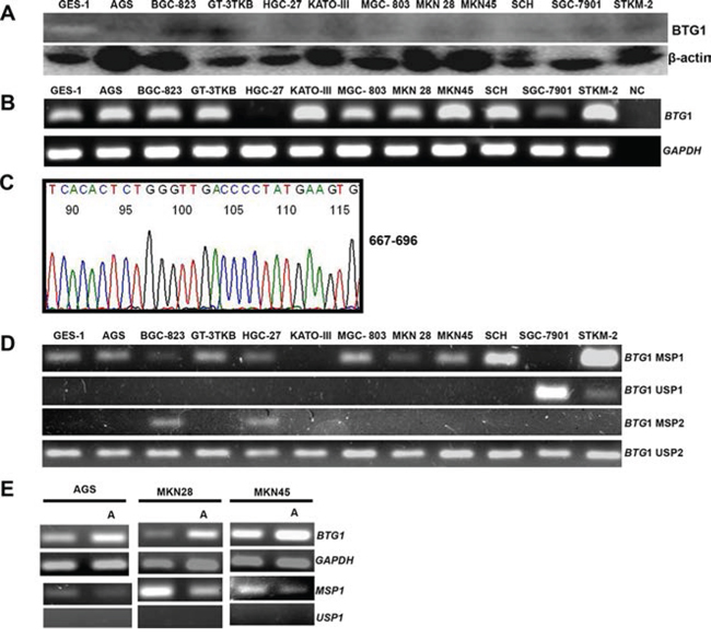 BTG1 expression and methylation in gastric cancer cell lines.