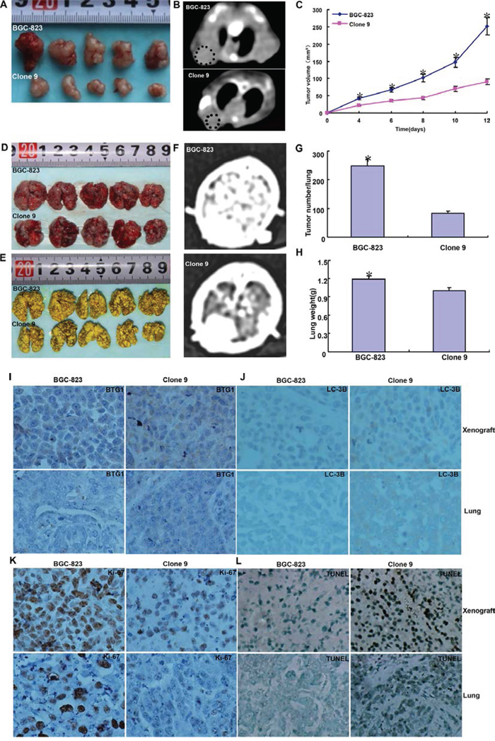 BTG1 suppresses the growth and lung metastasis of gastric cancer cells.