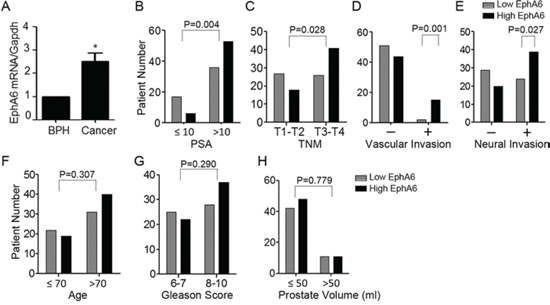 EphA6 expression is positively correlated with vascular invasion and neural invasion of CaP.