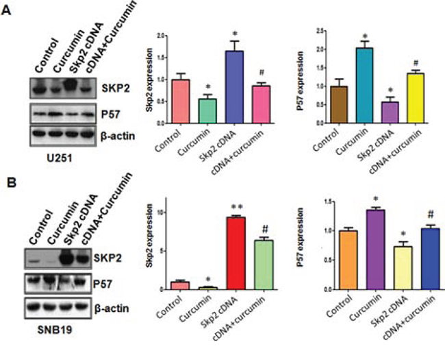 The expression of Skp2 and p57 was measured in Skp2 cDNA transfected glioma cells treated with curcumin.