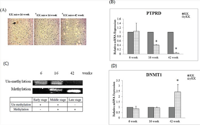 PTPRD protein was inhibition by T2D development duration in mice.