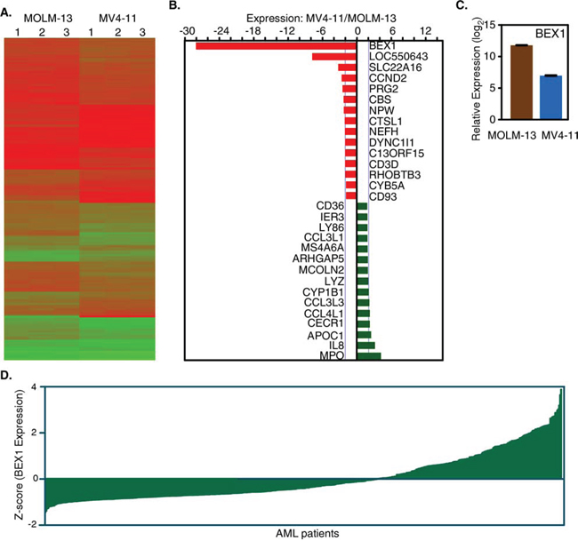 Deregulated gene expression in MV4-11 and MOLM-13 cell lines.