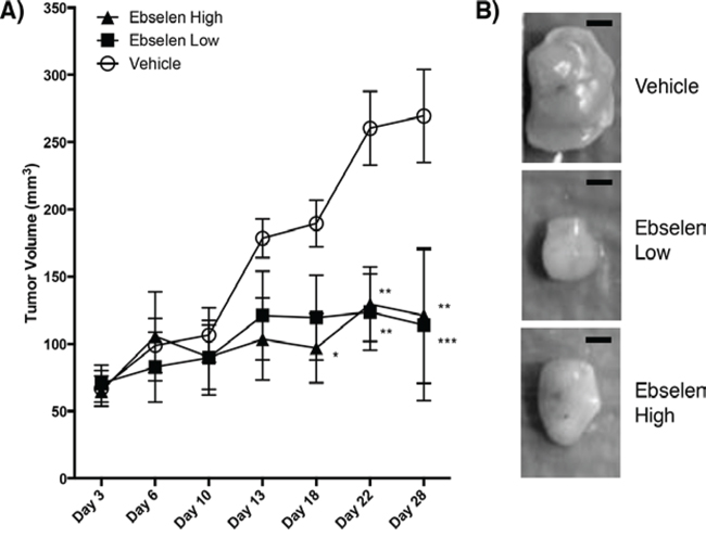 Ebselen treatment of nude mice bearing human tumors.