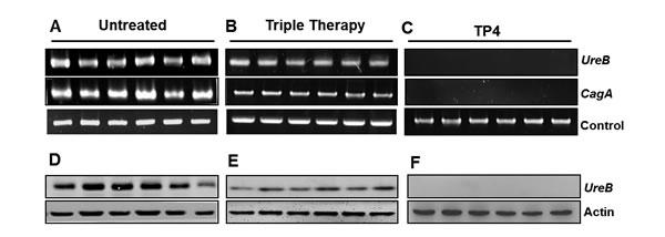 Effects of TP4 on gene and protein expression of
