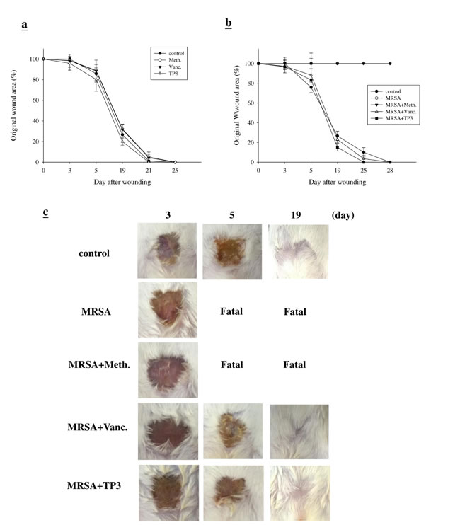 Closure of clean and contaminated wounds.