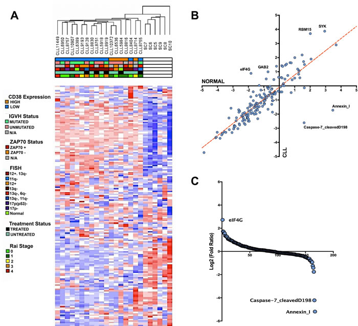 Altered protein landscape common among CLL patients.