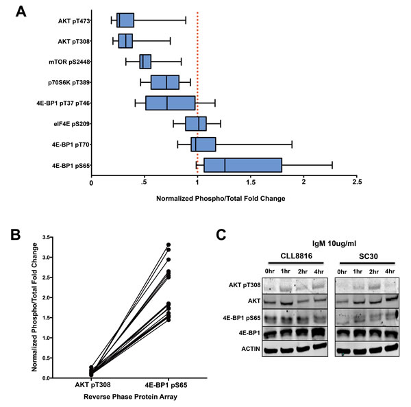 4E-BP1 serine 65 phosphorylation is independent of AKT/mTOR activation in CLL.