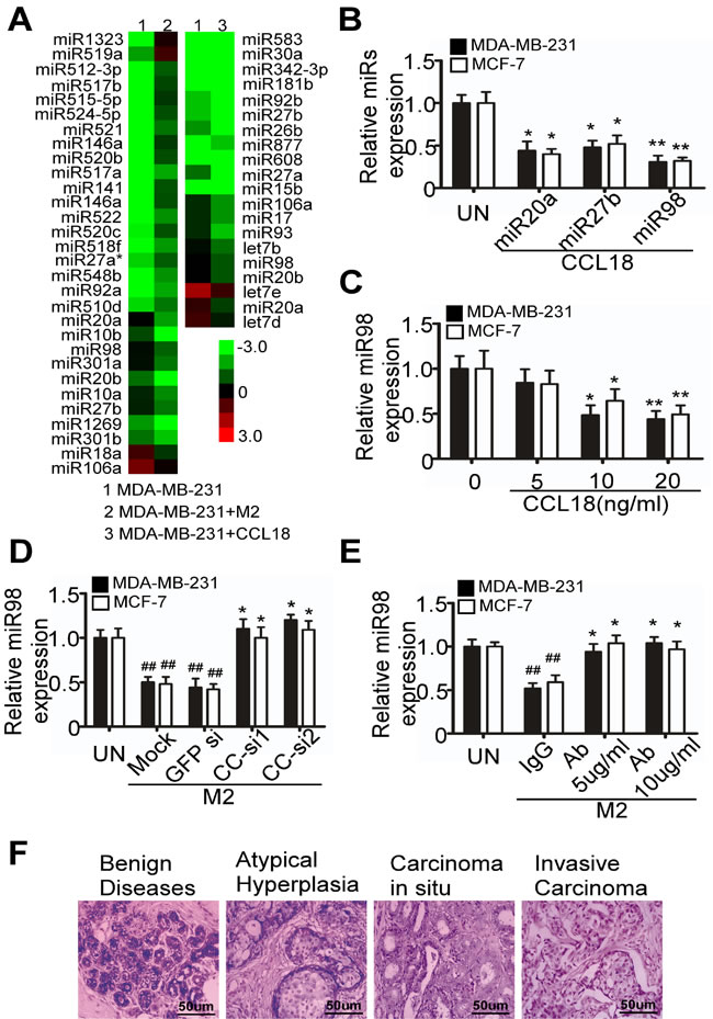 M2 macrophages decrease the expression of miR98 via CCL18 in breast cancer cells.