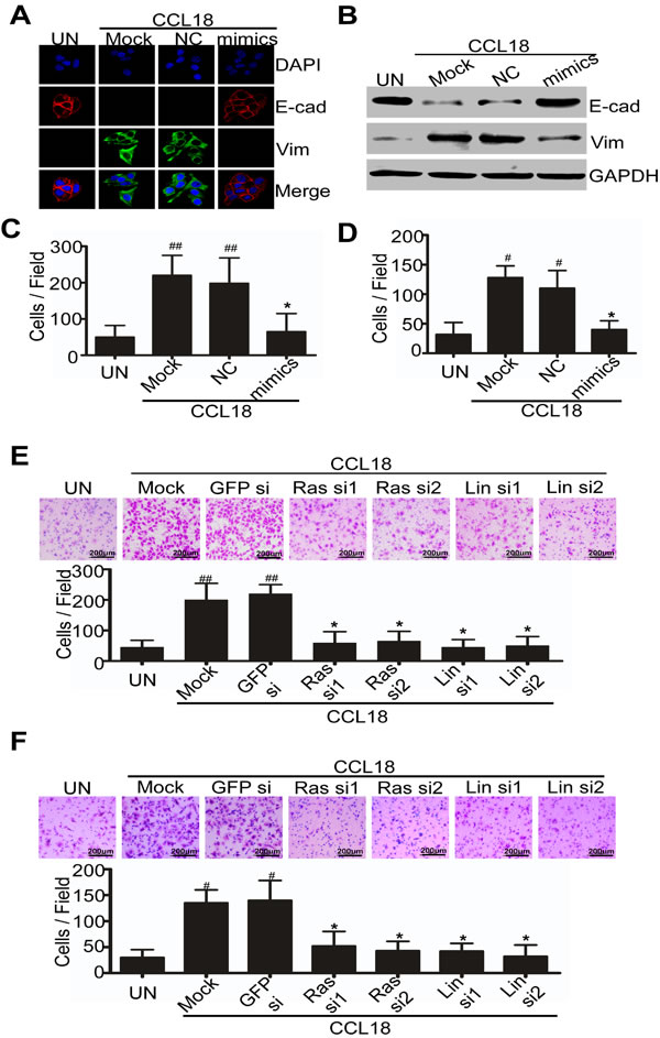 CCL18 reduces miR98 expression to enhance EMT, migration and invasion of breast cancer cells.