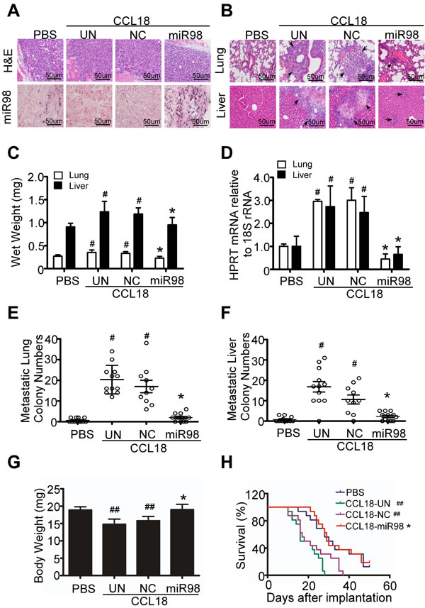 CCL18 decreases miR98 level to enhance the invasion and metastasis of breast cancer