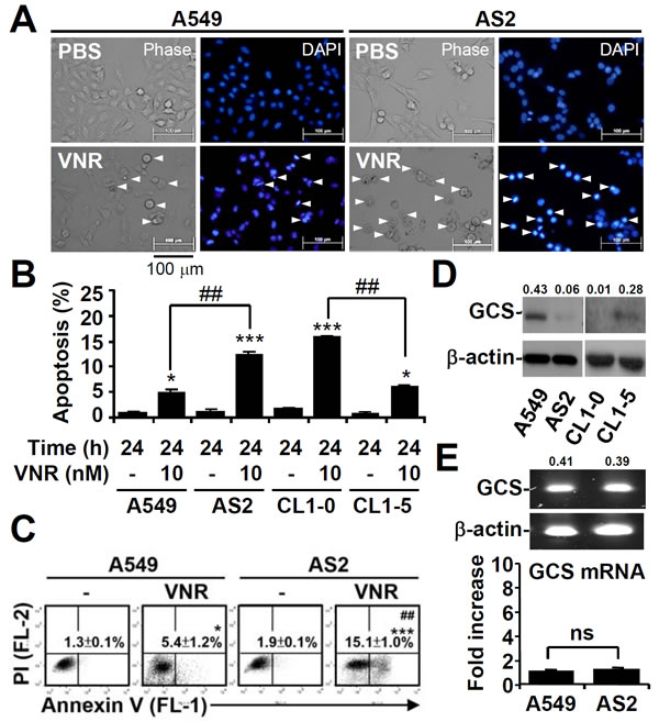 High expression of GCS in lung cancer cells resistant to VNR-induced apoptosis.