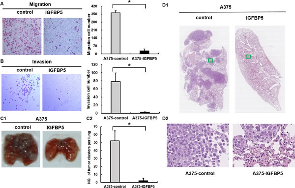 IGFBP5 inhibits cell migration and invasion