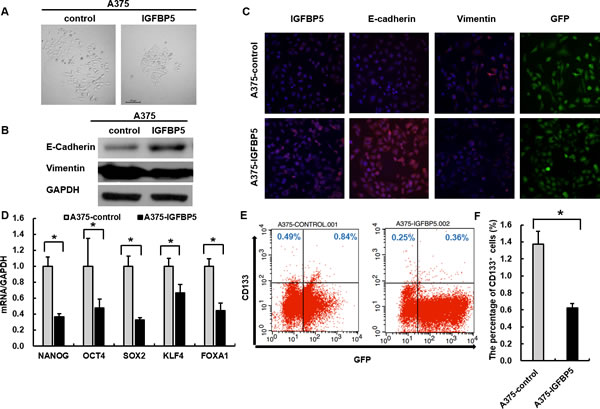 IGFBP5 suppresses EMT and stem cell features of tumor cells.