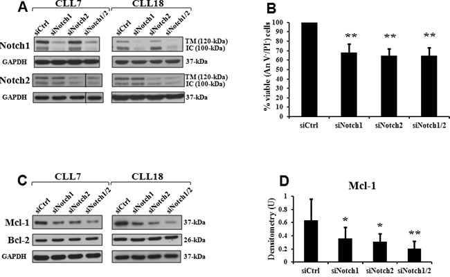 Notch1 and Notch2 silencing decreases cell viability and expression of Mcl-1 protein in CLL cells.