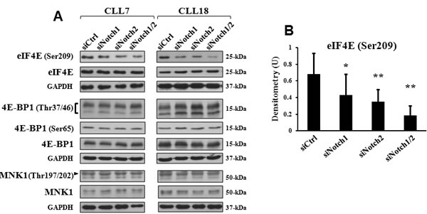 Mcl-1 downregulation by Notch silencing is associated with reduced phosphorylation of eIF4E.