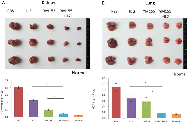 Antitumor effects of YM155 and/or IL-2 treatment on the growth of orthotopic and lung RENCA tumors in BALB/c mice.